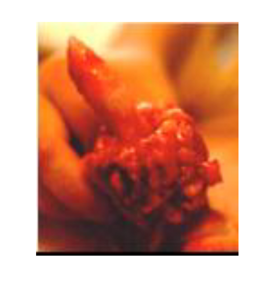 <p><span>Tumeur du pénis : chou-fleur à la place du pénis du chien. Traité par radiothérapie de contact.</span></p>