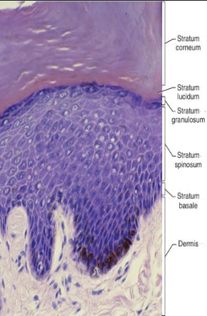 <ul><li><p>stratified keratinized squamous</p></li><li><p>layers</p><ul><li><p>stratum corneum</p></li><li><p>stratum lucidum —> thick</p></li><li><p>stratum granulosum —> keratohyalin, filaggrin, lamellar</p></li><li><p>stratum spinosum —> langerhans</p></li><li><p>stratum basale&nbsp;—> stem cells</p></li></ul></li></ul><p></p>