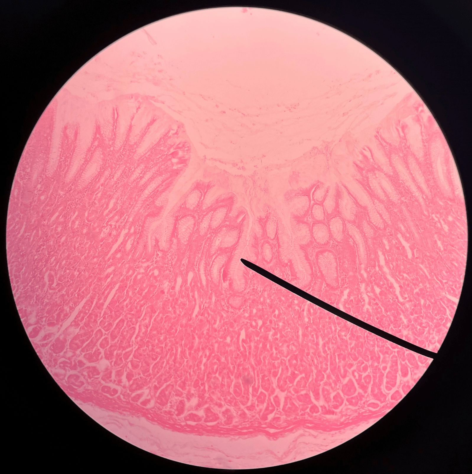 • Slide histology of the stomach.

• A microscopic invagination of the rugae of the stomach.