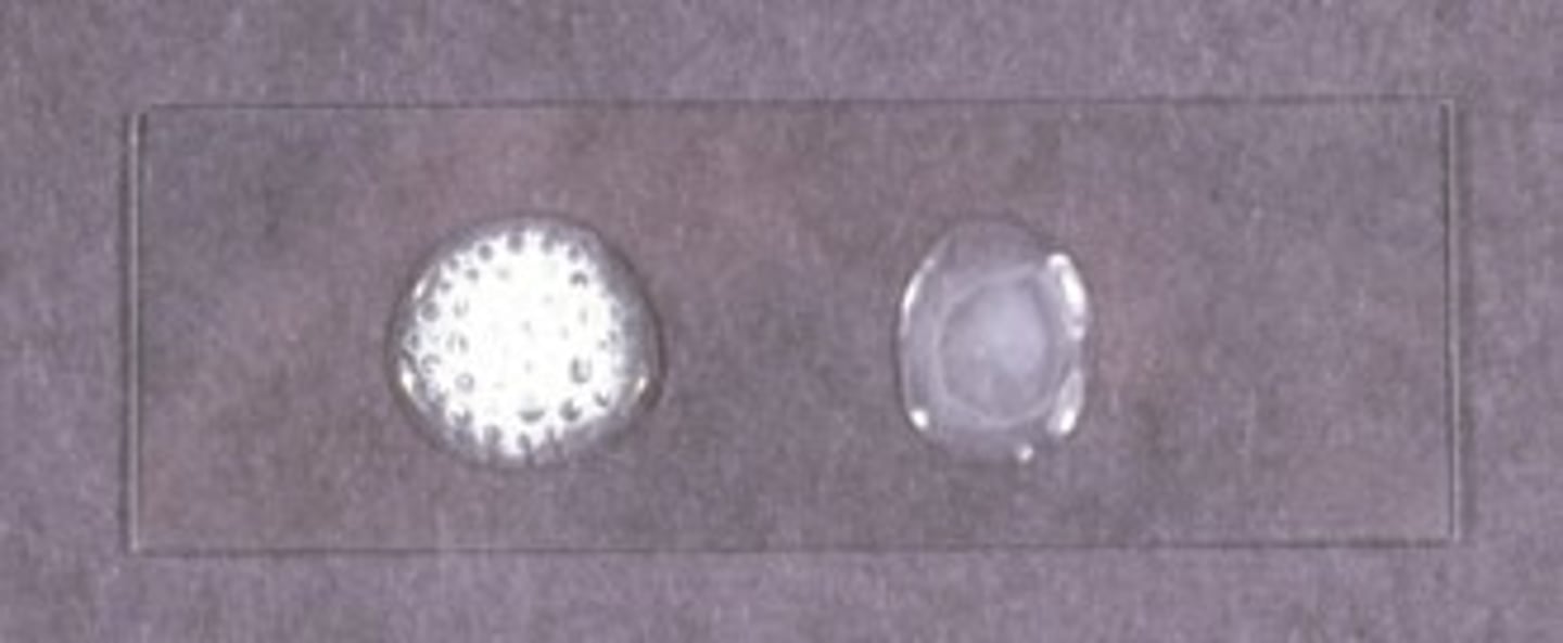 <p>Test that determines whether or not a bacteria has catalases to nuetralize H2O2 to water and oxygen gas to defend itself against oxidative damage and survive in the host</p>