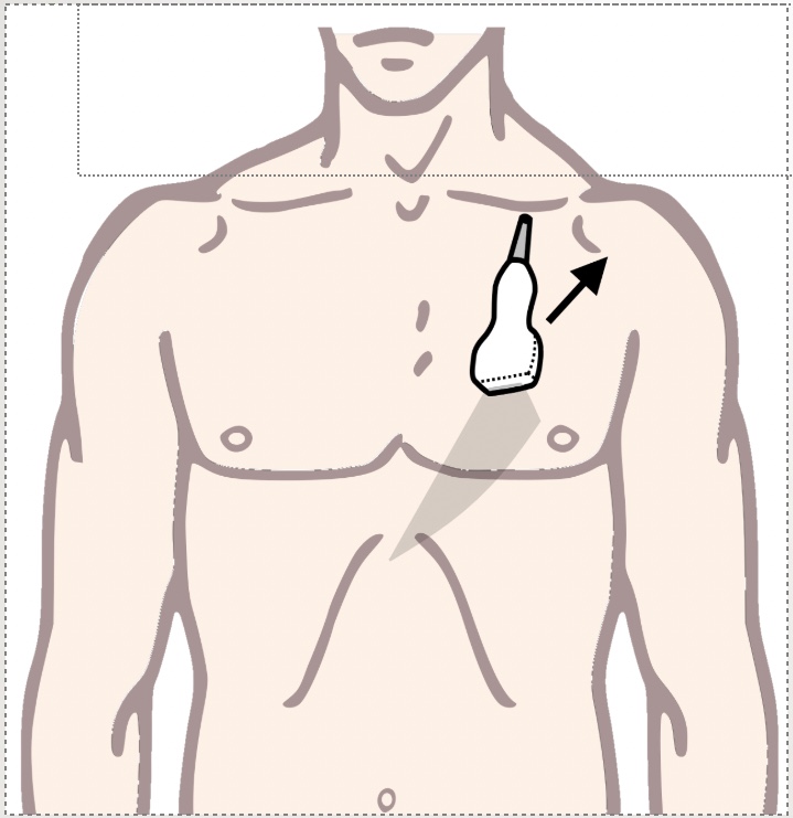 <p>What echocardiographic view will this obtain?</p>