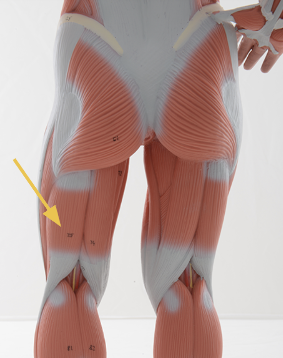 <p>biceps femoris m. </p><p><span>O: ischial tuberosity (long head), linea aspera and lateral supracondylar line (short head)</span></p><p><span>I: head of fibula</span></p><p><span>Action(s): knee flexion, hip extension, lateral rotation of femur when hip is extended</span></p><p><span>Innervated by tibial and common fibular nerve</span></p>