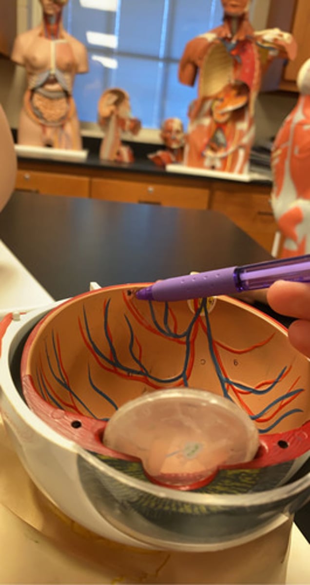 <p>The pink dot (not the black in the middle)</p>