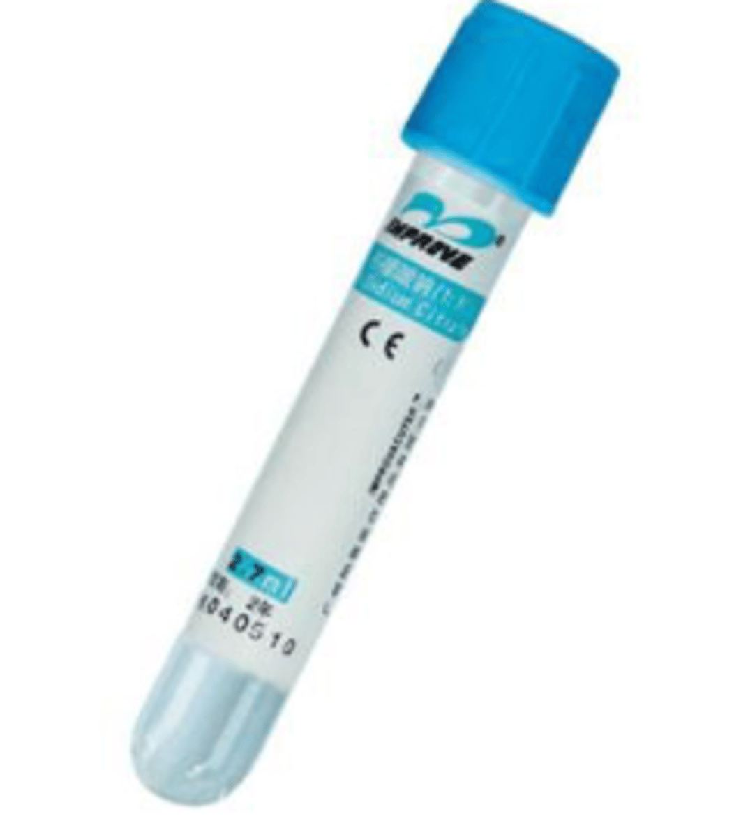 <p>anticoagulant: sodium citrate <br>coagulation testing (plasma and platelet function)</p>