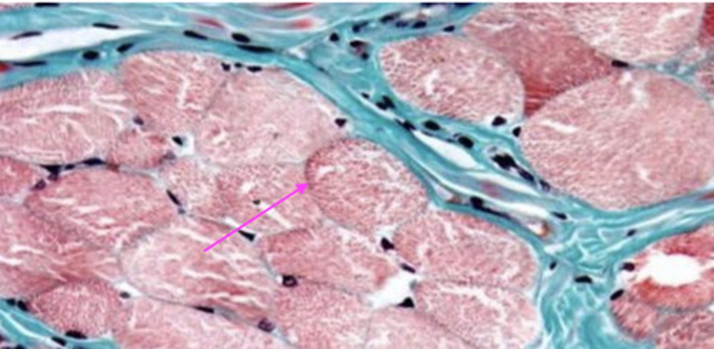 <p>what type of tissue is surrounding this structure?</p>