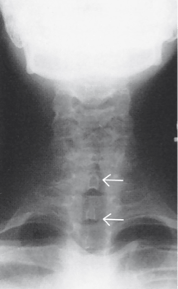 <p>What X-ray is shown</p>