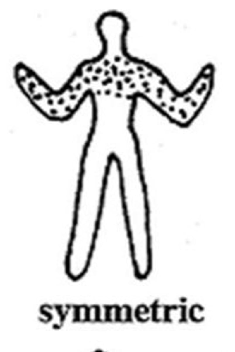 <p>lesions appear to be distributed in a similar arrangement on differing sides of the body</p>