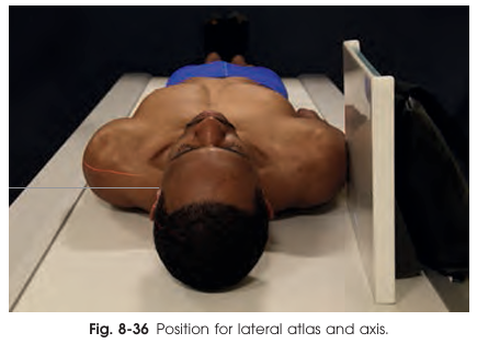 <p>Patient&nbsp;position in the lateral&nbsp;projection of the atlas and axis</p>