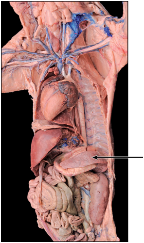 <p>Name the anatomical feature shown on the image of the deep viscera and associated structures.</p>