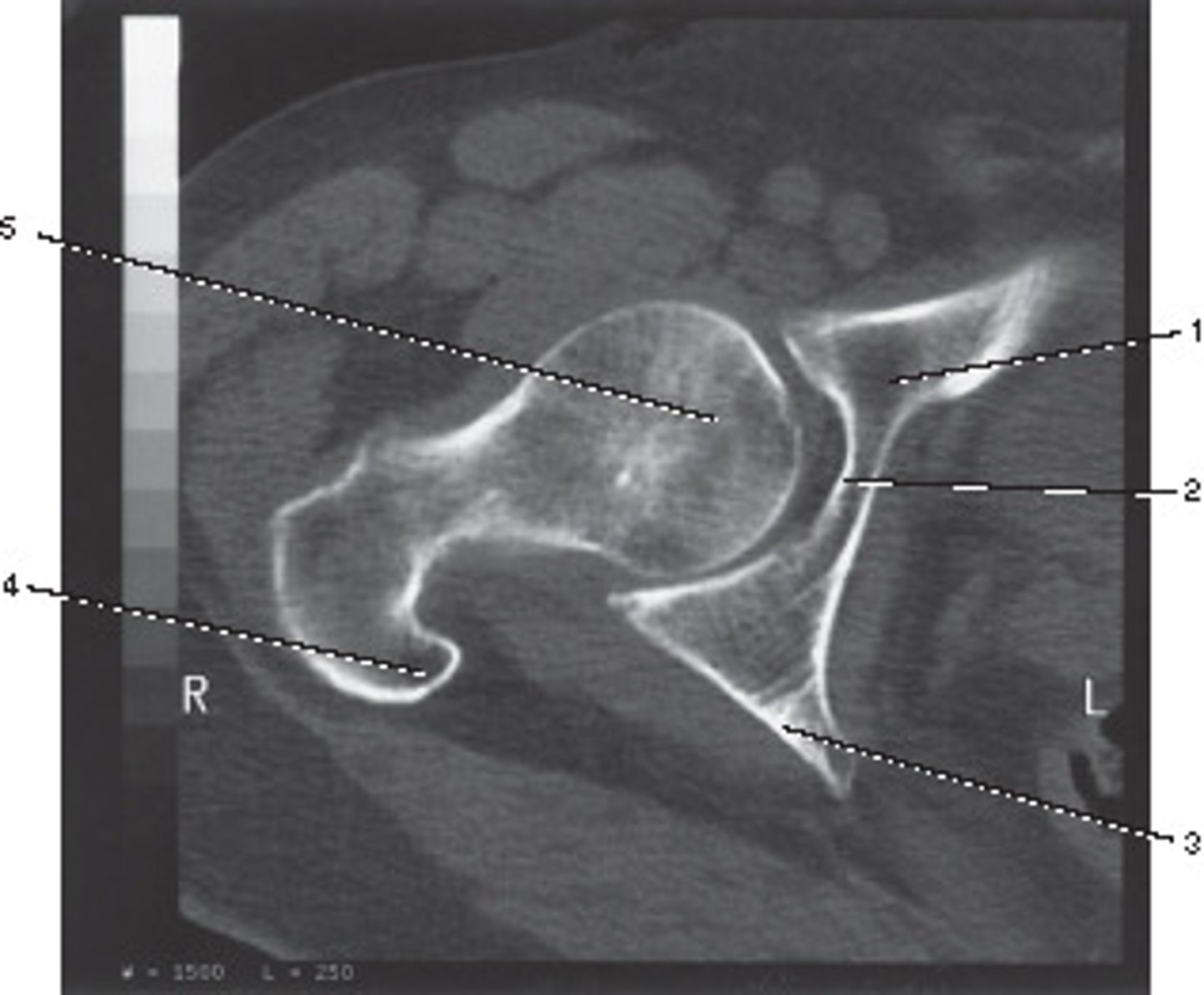 <p>What number corresponds to the acetabulum?</p>