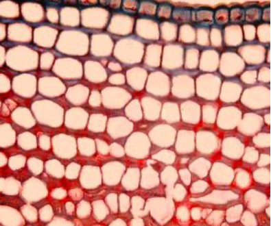 <p>What type of collenchyma cell is this?</p>