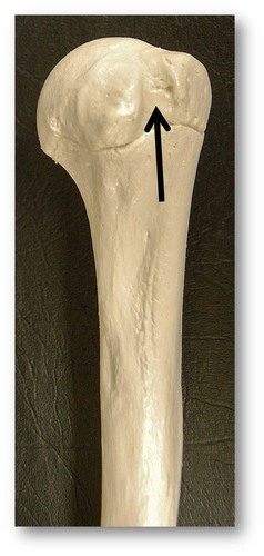 Name this specific part of the humerus.