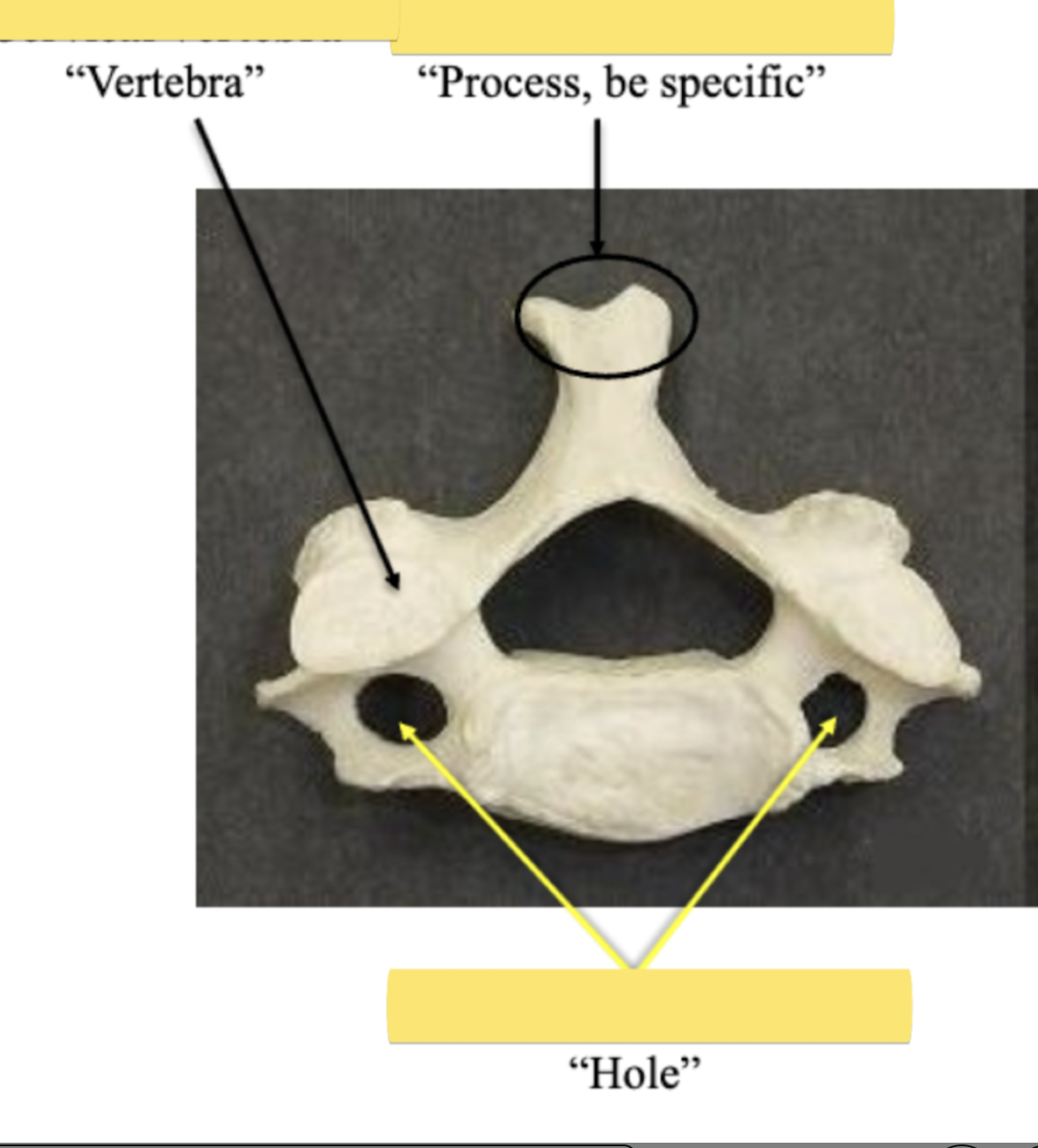 <p>Label the <strong>hole</strong> be specific</p>