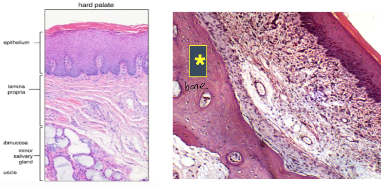 <ul><li><p>keritinized stratified squamous supported by LP</p></li><li><p>Upper layers supported by spicular bone</p></li></ul>