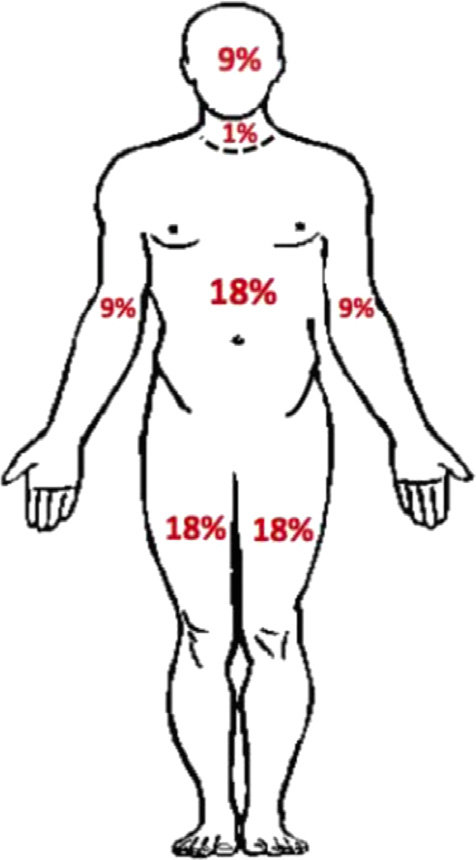<p>Head: 9%</p><p>Neck: 1%</p><p>Arms (1): 9%</p><p>Legs (1): 18%%</p><p>Back: 18%</p><p>Chest/Abdomen: 18%</p><p>Groin: 1%</p>
