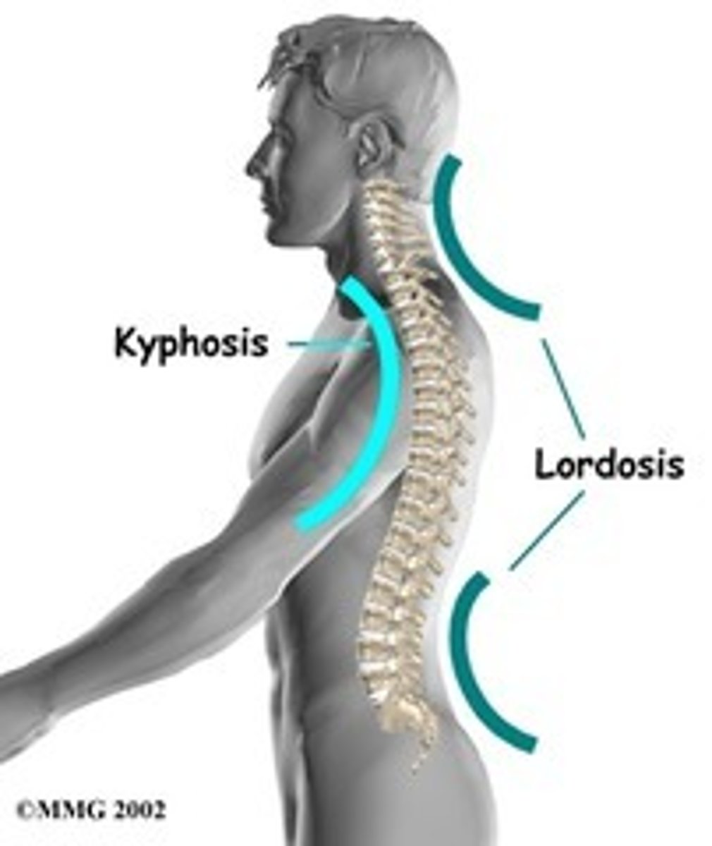 <p>Excessive inward curve of spine.</p>