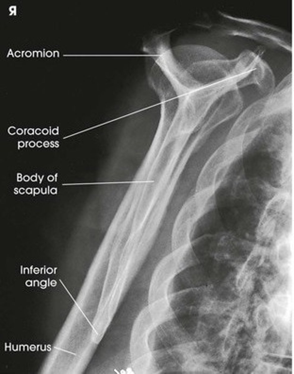 <p>1. What projection is shown in the image?</p><p>2. What are the clinical indications for this projection?</p><p>3. Is this an optimal image?</p><p>4. Name all of the anatomy.</p><p>5. Does this image meet all criteria?</p><p>6. Where is the CR placed?</p><p>7. If applicable, what method is interchangeable with this projection?</p>