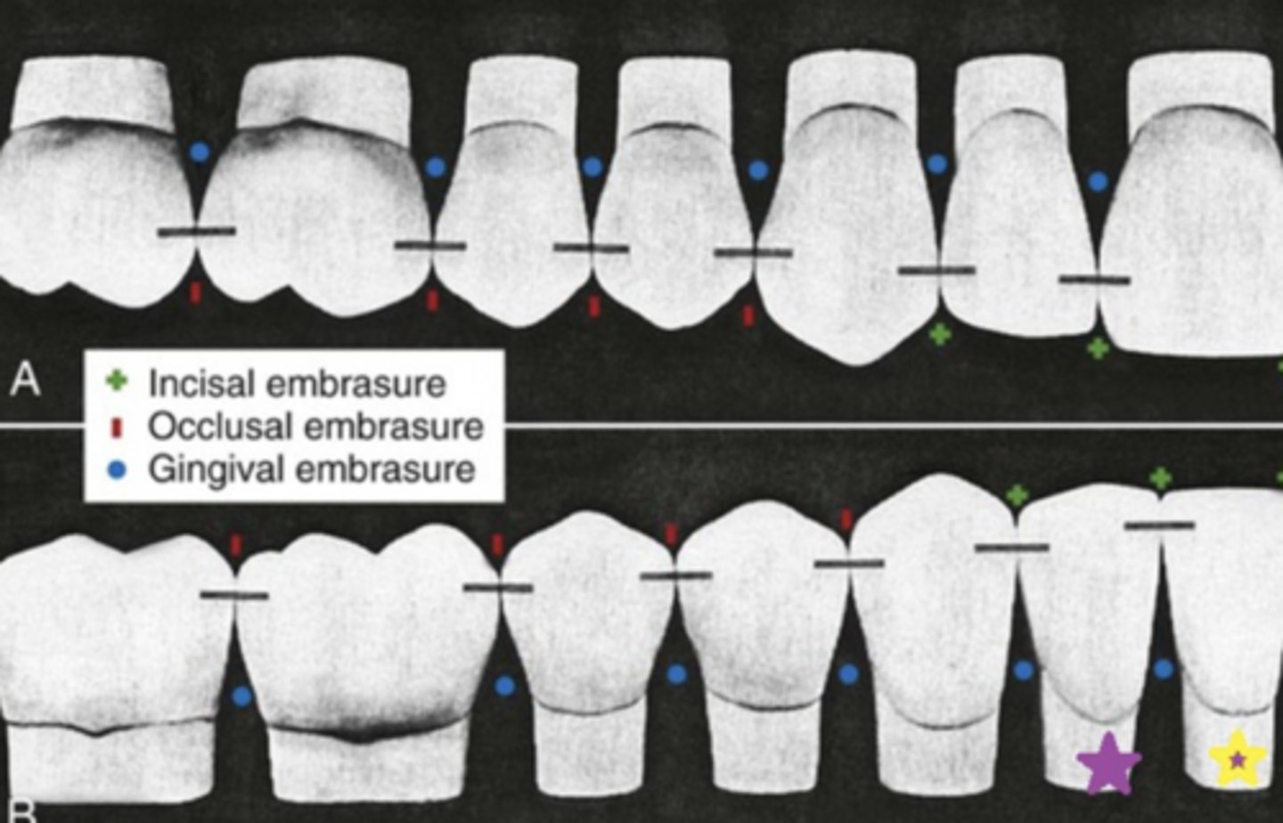 knowt flashcard image
