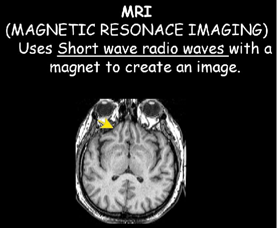 It uses *short wave radio waves* with a magnet to create an image.