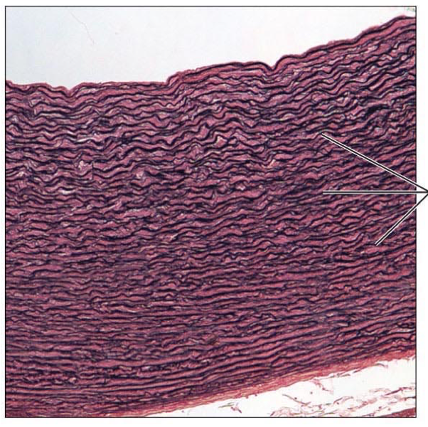 <p>elastic</p>