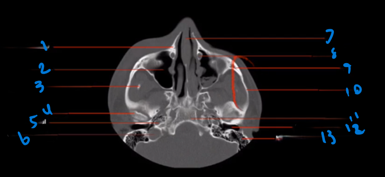 <p>What is the nasal septum composed of?</p>