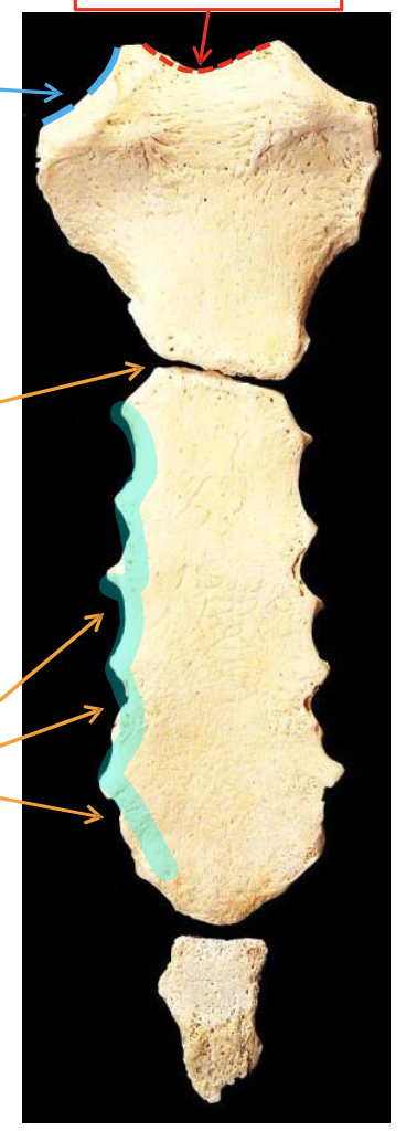 <p>The highlighted region contains facets for</p>