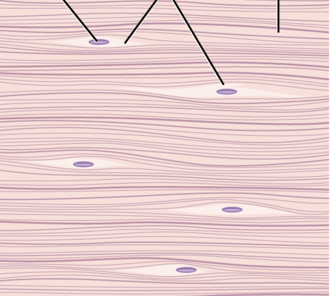 <p>mostly fibrous connective tissue, is vascular</p>