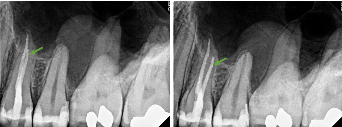 <p>which RCT of #12 is indicated by the green arrow </p>