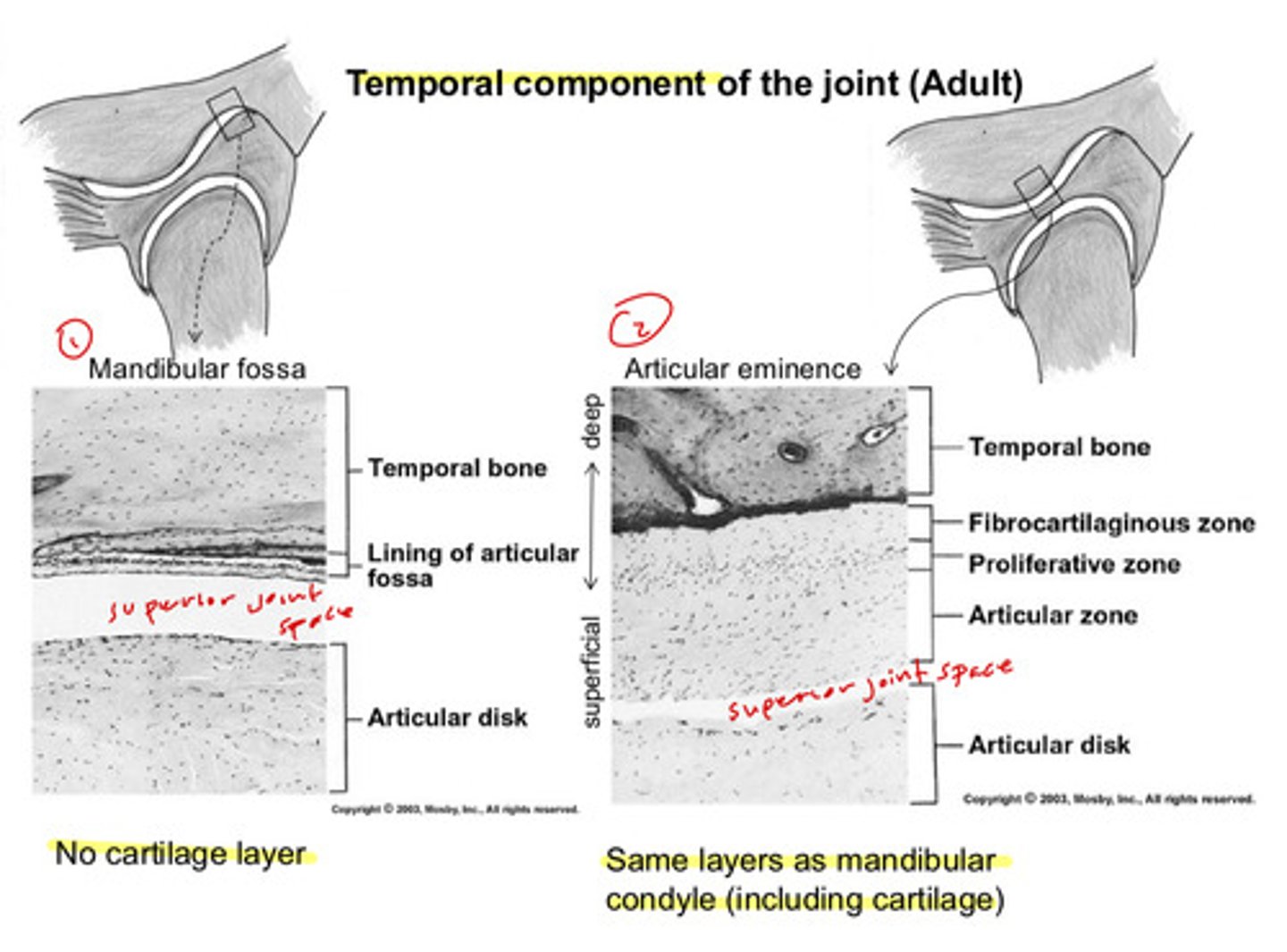 <p>1) temporal bone</p><p>2) lining of articular fossa</p><p>superior joint space in between</p><p>3) articular disk underneath</p><p>there is no cartilage layer</p>