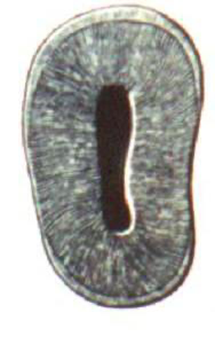 <p>what tooth's root canal has a "Kidney shaped" or<br>"Figure 8" shape?</p>