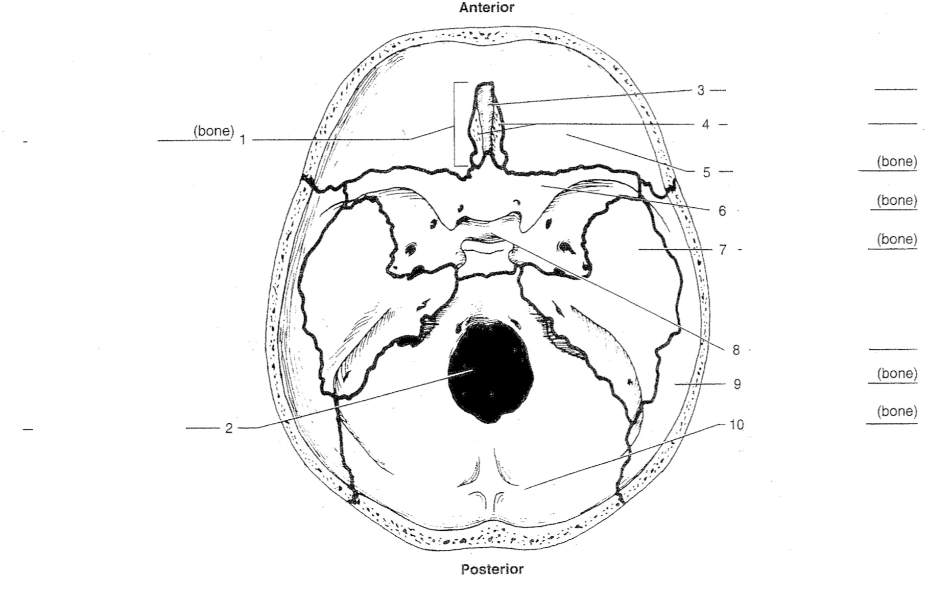 Cribiform plate