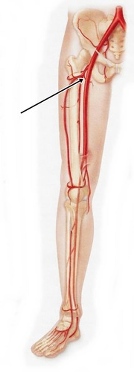 <p>-branch of the femoral artery</p><p>-passes between iliopsoas and pectineus to posterior femoral head and neck (anterior to quadratus femoris muscle)</p>
