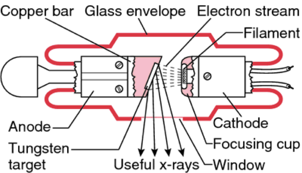 <ul><li><p class="Paragraph SCXO246912595 BCX4" style="text-align: left;"><span style="background-color: inherit; line-height: 19.55px; color: windowtext;"><span>Anode, cathode and part of copper stem are housed in an airtight glass envelope</span></span><span style="line-height: 19.55px; color: windowtext;"><span> </span></span></p></li><li><p class="Paragraph SCXO246912595 BCX4" style="text-align: left;"><span style="background-color: inherit; line-height: 19.55px; color: windowtext;"><span>Glass vacuum and everything in it is bathed in oil to insulate it and help conduct heat away from the anode</span></span><span style="line-height: 19.55px; color: windowtext;"><span> </span></span></p></li><li><p class="Paragraph SCXO246912595 BCX4" style="text-align: left;"><span style="background-color: inherit; line-height: 19.55px; color: windowtext;"><span>Then it is earthed and encased in a lead lined metal casing</span></span><span style="line-height: 19.55px; color: windowtext;"><span> </span></span></p></li><li><p class="Paragraph SCXO246912595 BCX4" style="text-align: left;"><span style="background-color: inherit; line-height: 19.55px; color: windowtext;"><span>These stationary anode machines are limited by the amount of heat they produce so they are only able to produce a primary beam of low intensity</span></span><span style="line-height: 19.55px; color: windowtext;"><span> </span></span></p></li><li><p class="Paragraph SCXO168107112 BCX4" style="text-align: left;"><span style="background-color: inherit; line-height: 19.55px; color: windowtext;"><span>More powerful machines require a rotating anode in order to produce enough x rays to penetrate large areas</span></span><span style="line-height: 19.55px; color: windowtext;"><span> </span></span></p></li></ul><p class="Paragraph SCXO246912595 BCX4" style="text-align: left;"><span style="line-height: 19.55px; color: windowtext;"><span> </span></span></p>