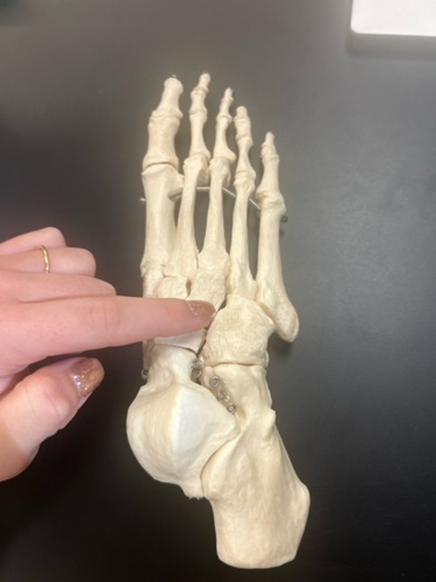 <p>name the bone</p>