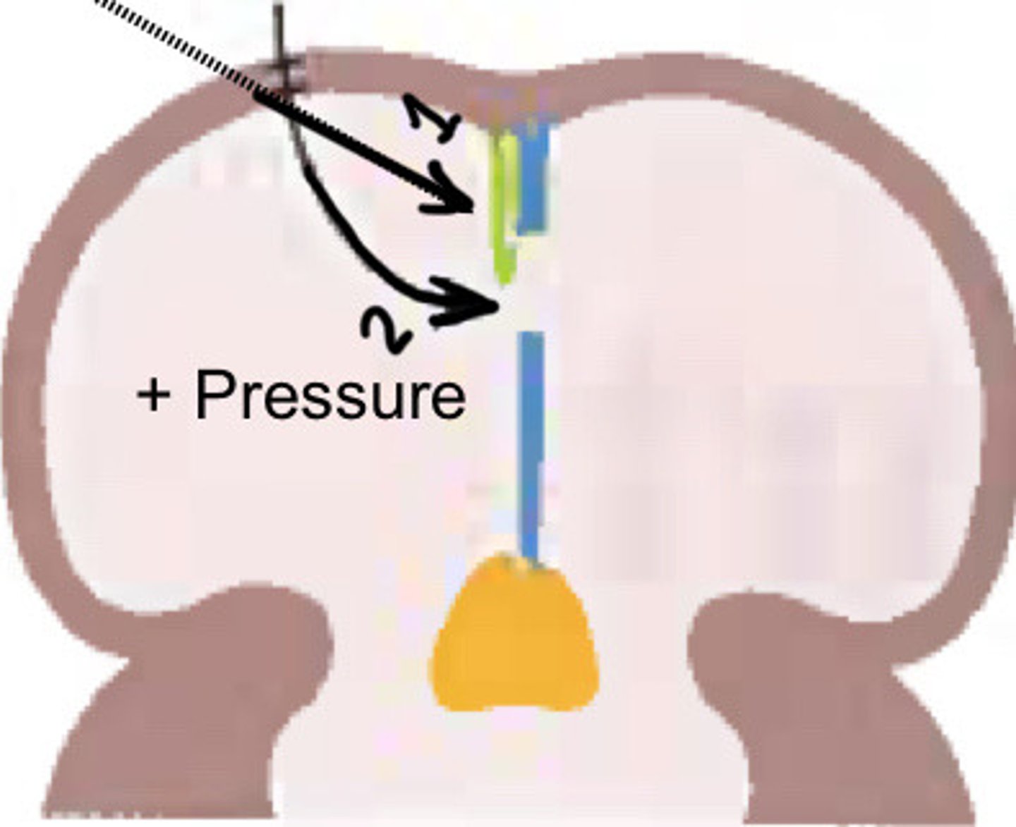 <p>What is 1</p>