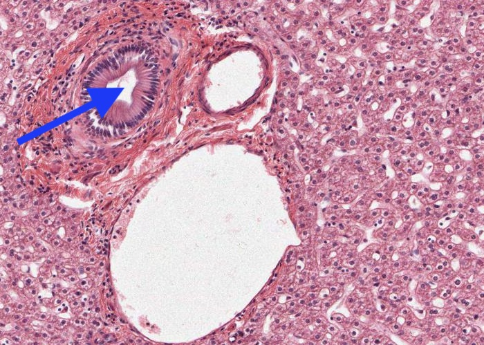 <p>The circular structure who clumen is arrowed is a?</p>