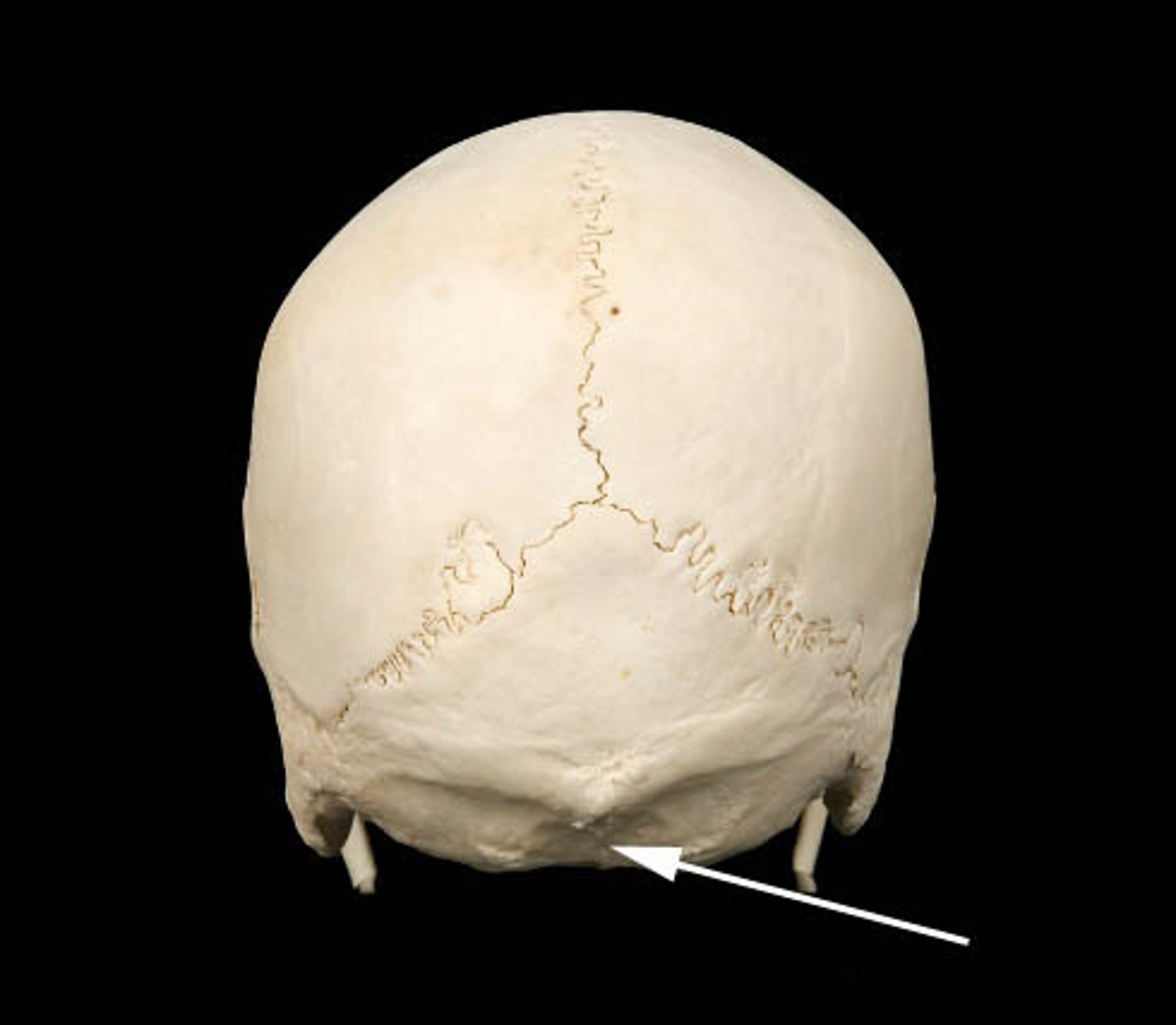 <p>This crest, or median nuchal line, is a highly variable median line or crest that passes between the right and the left nuchal musculature. It stretches from the external occipital protuberance to the rear of the foramen magnum, anchoring the nuchal ligament.</p>