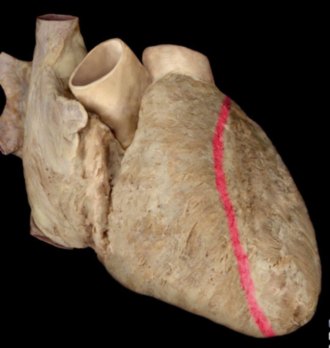 <p>A groove that contains the left coronary artery and marks the separation of ventricles on the outside surface of the heart.</p>