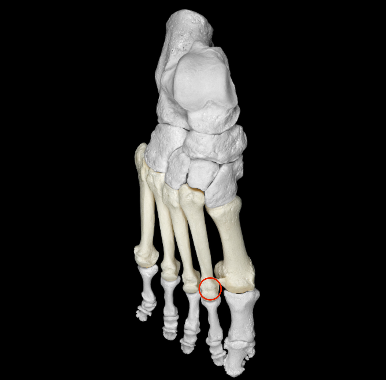 <p>anterior end of a metatarsal</p>