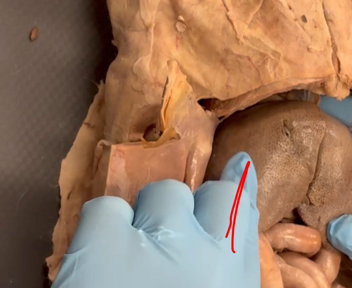 <p>Red finger is touching which lobe</p>