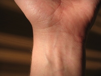 <p>Wrist </p>