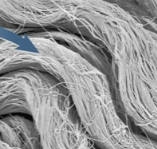 <p>Reticular layer</p>