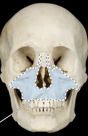 <p><strong>Maxilla</strong></p>