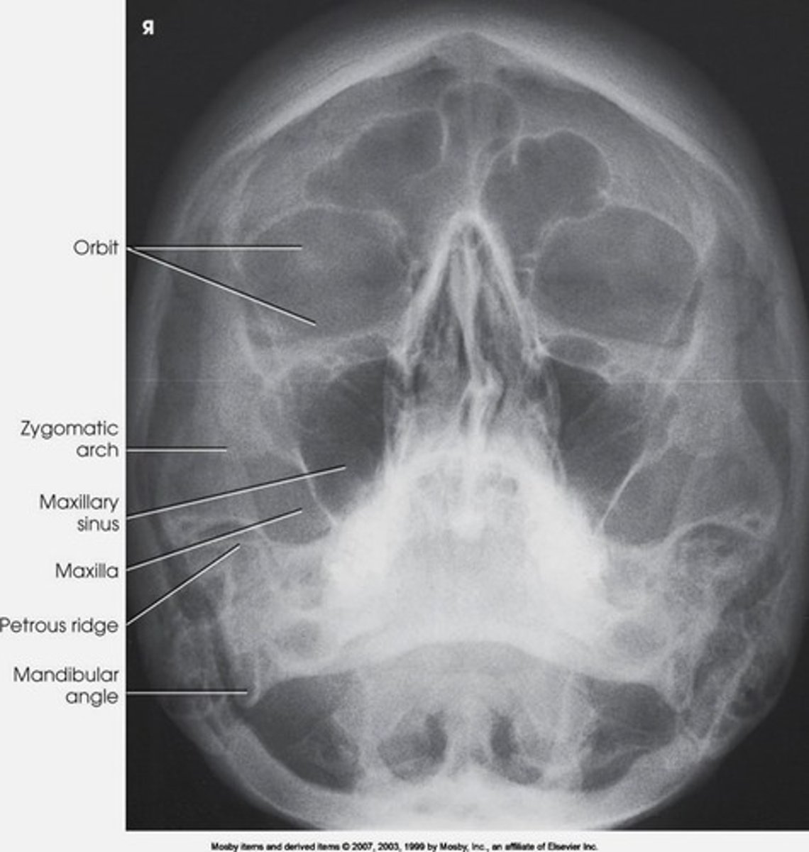 <p>shows maxillary sinuses</p><p>xray beam directed from behind head</p>