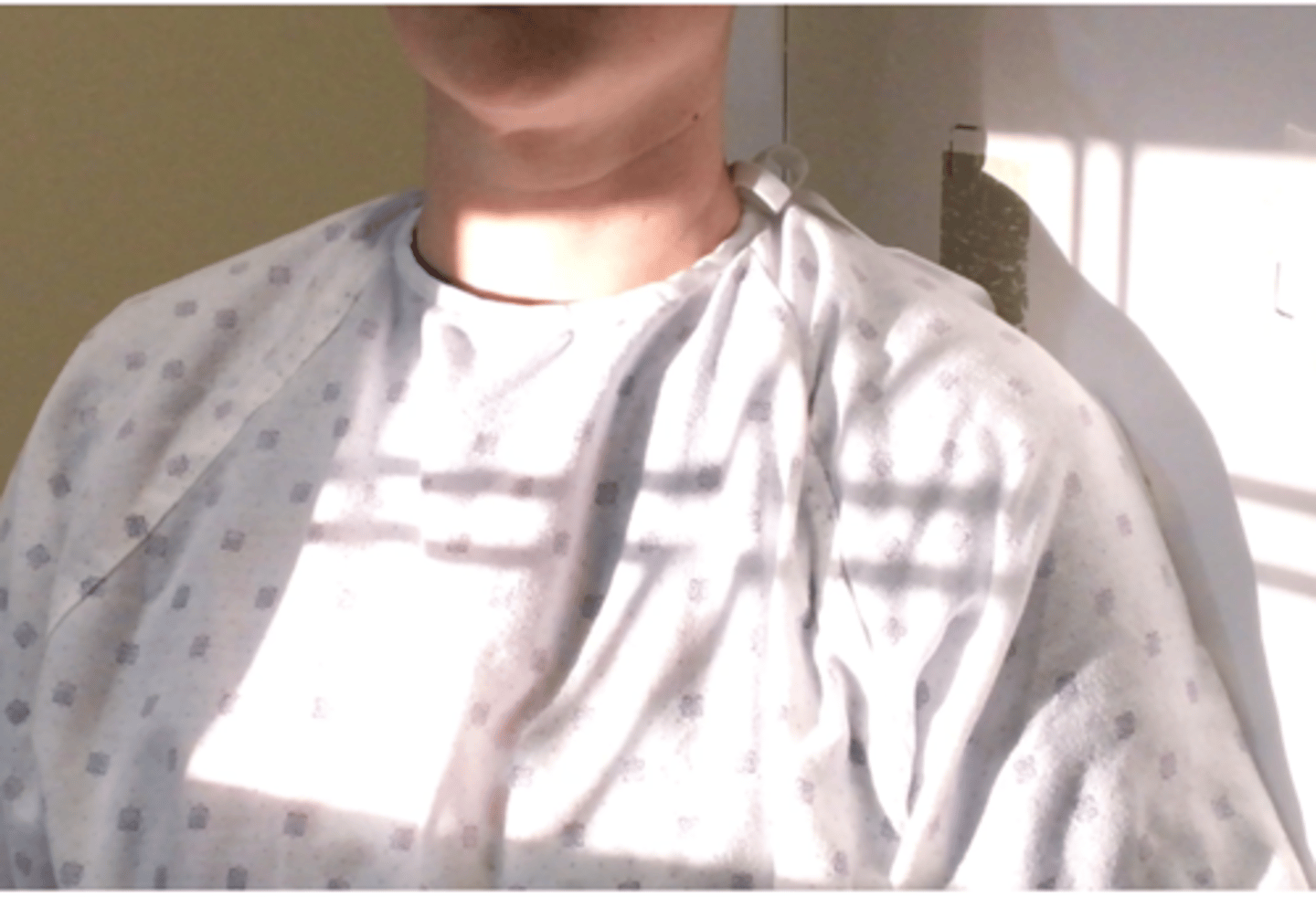 <p>Pt Placement: AP position, rotate patient away from bucky</p><p>Collimation: 12x10</p><p>CR Placement: Glenohumeral joint space 1" below coracoid process which puts top of light 1.5" above shoulder </p><p>Tube tilt: None</p><p>SID: 40"</p><p>Breathing: DBDM</p>