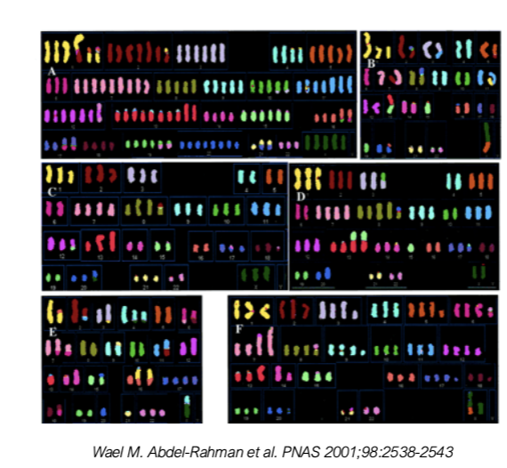 <ul><li><p>numerical and structural chromosomal instability</p></li><li><p>translocation b/w chromosomes</p></li><li><p>extra chromosomes (genome may be doubled)</p></li></ul><p></p>