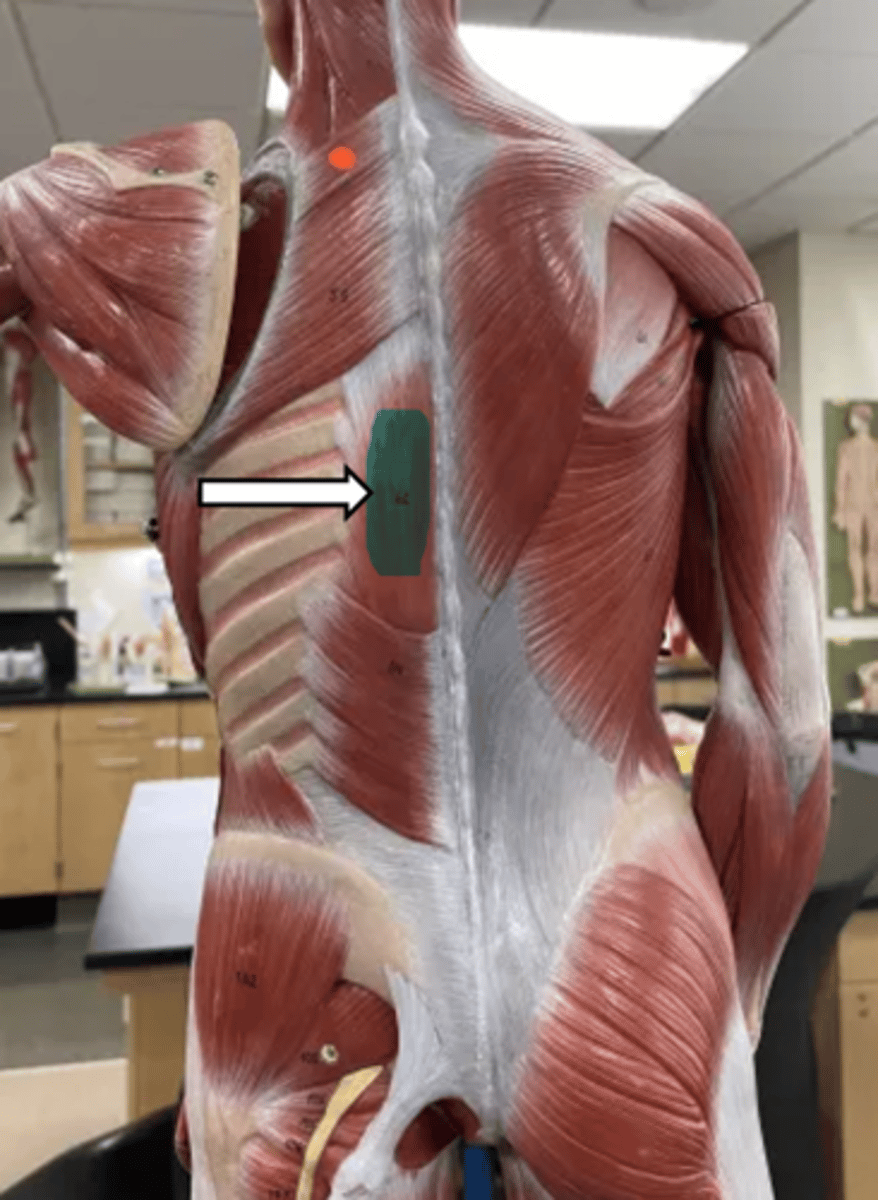 <p>name the muscle</p>
