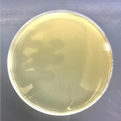 <p>: Name the qualitative method for the isolation of pure culture of microorganisms.</p>