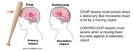 <p>Coup &amp; Contrecoup</p>