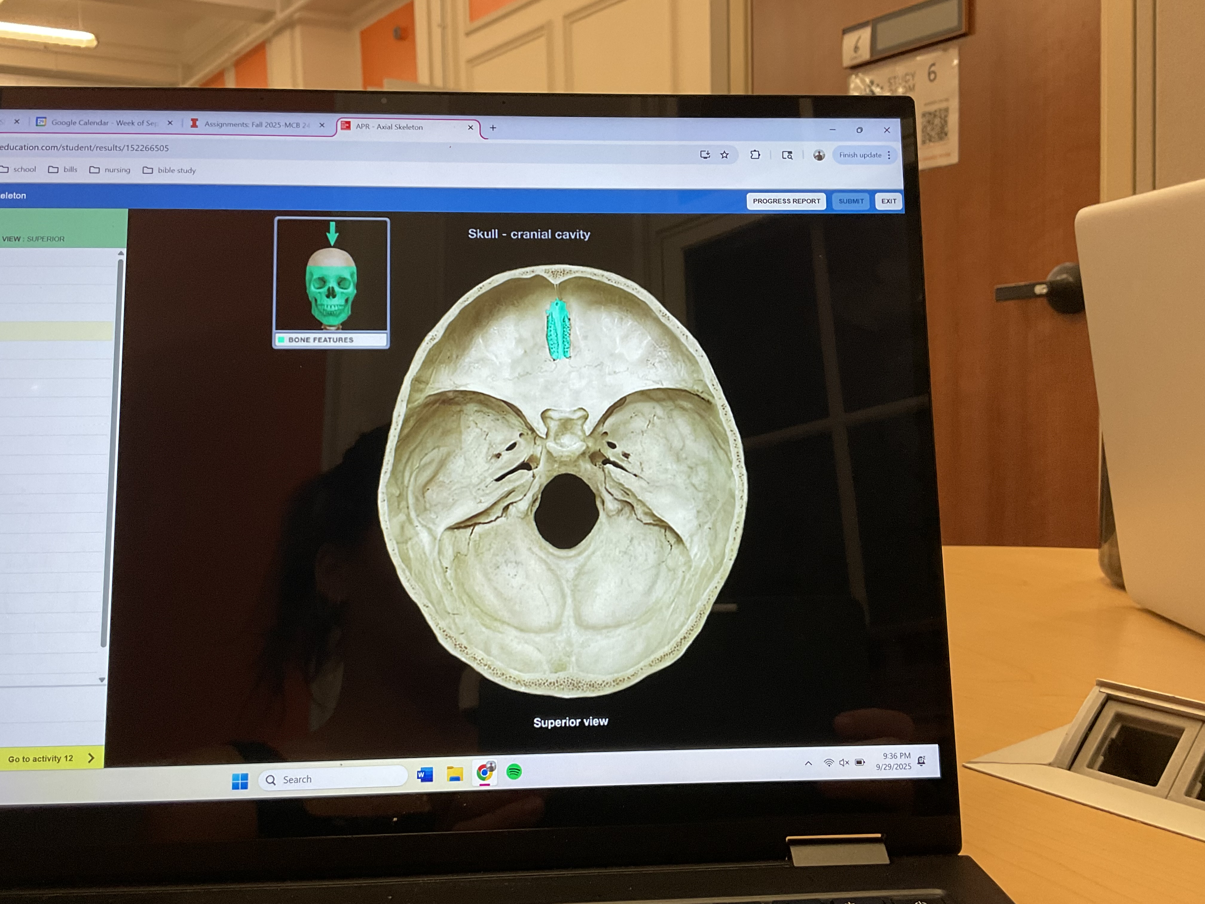 <p>Ethmoid bone </p>